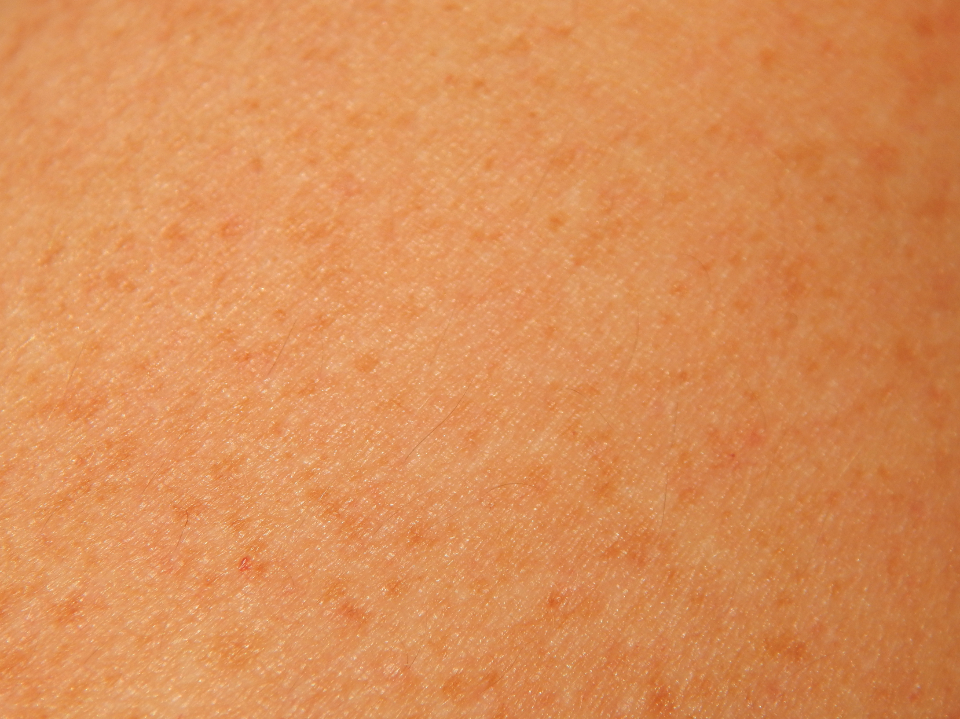 Skin Texture